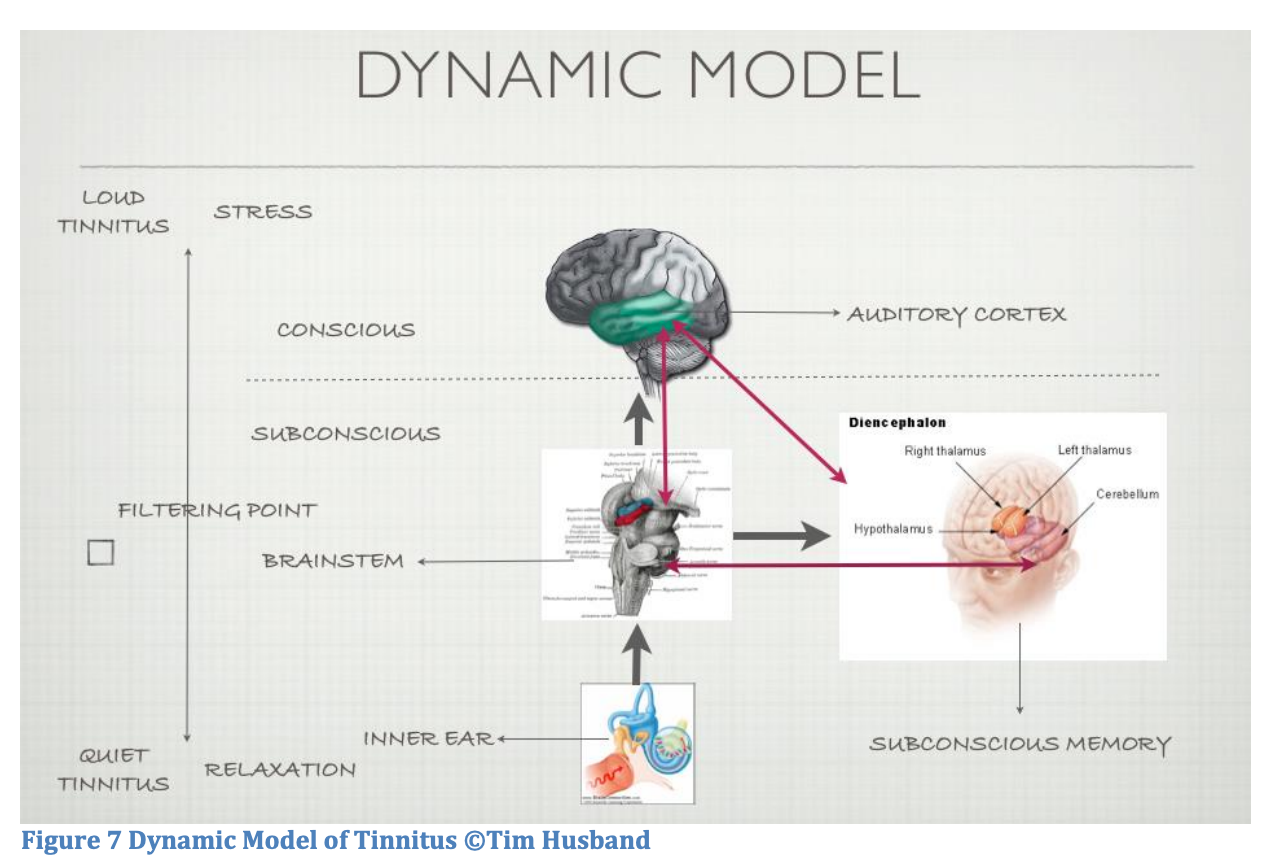 the dynamic model of tinnitus
